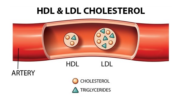 Cholesterol trong máu gồm cholesterol tốt (HDL) và  cholesterol xấu (LDL)